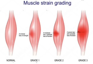 muscle stain grading